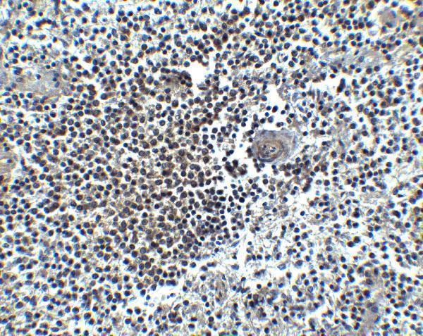 a00031 1 cxcr4 primary antibodies ihc testing 8