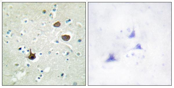 Immunohistochemistry analysis of paraffin-embedded human brain, using CXCR4 (Phospho-Ser339) Antibody