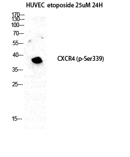 Western Blot analysis of HuvEc etoposide 25uM 24H cells using Phospho-Fusin (S339) Polyclonal Antibody