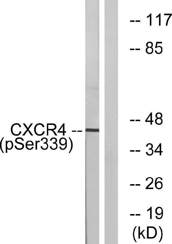 Western blot analysis of lysates from HUVEC cells treated with etoposide 25uM 24H, using CXCR4 (Phospho-Ser339) Antibody
