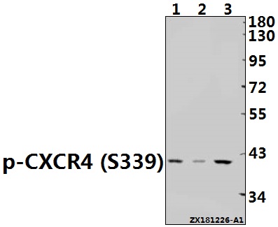 Western blot (WB) analysis of p-CXCR4 (S339) pAb at 1:500 dilution
Lane1:Myla2059 whole cell lysate(40ug)
Lane2:K562 whole cell lysate(40ug)
Lane3:Jurkat whole cell lysate(40ug)