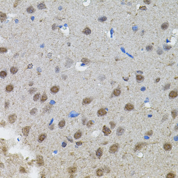a00032 mycn primary antiboties ihc testing 2
