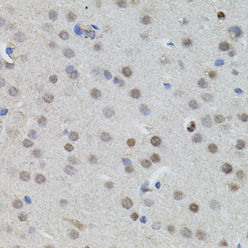 a00032 mycn primary antiboties ihc testing 3