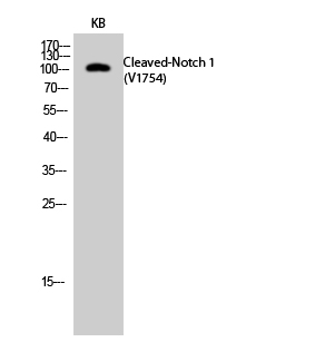 Western Blot analysis of KB cells using Cleaved-Notch 1 (V1754) Polyclonal Antibody diluted at 1:500