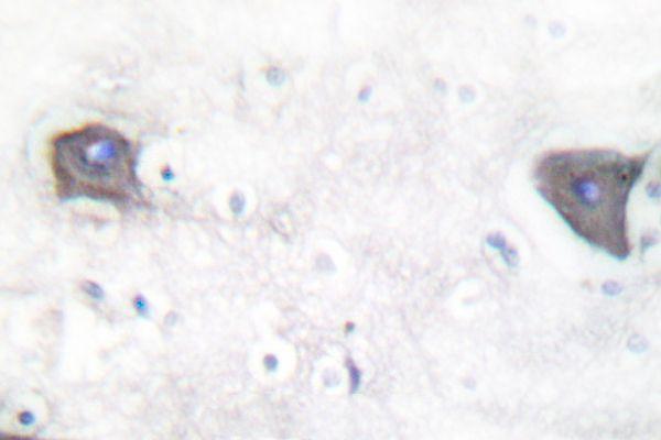 a00033 4 notch1 primary antiboties ihc testing 2
