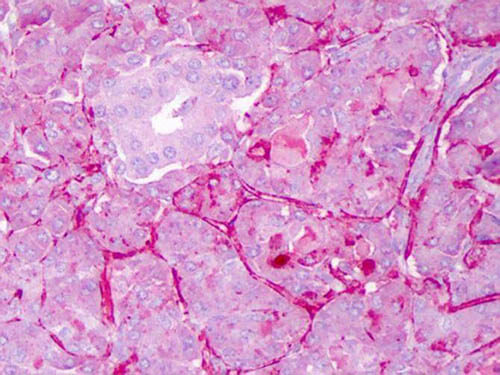 a00033 notch1 primary antibodies ihc testing 1