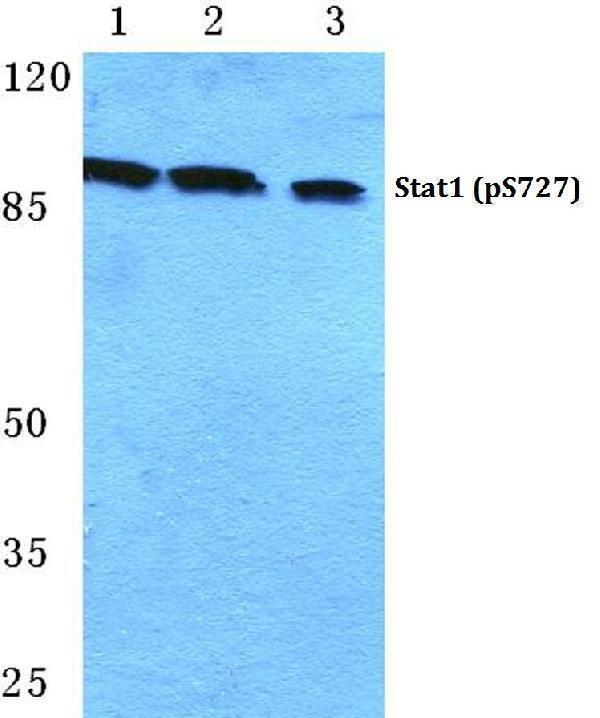 a00036s727 1 stat1 primary antiboties wb testing 1