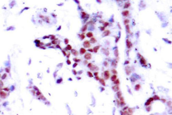a00036y701 2 stat1 primary antiboties ihc testing 2