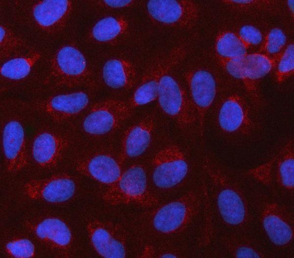  IF analysis of CBLIF using anti-CBLIF antibody (A00038-1)