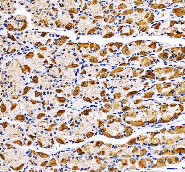 IHC analysis of CBLIF using anti-CBLIF antibody (A00038-1)