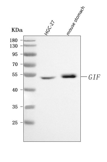  Western blot analysis of CBLIF using anti-CBLIF antibody (A00038-1)