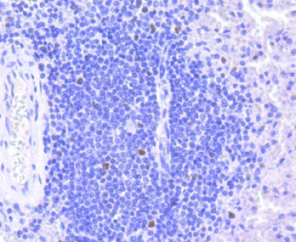 Immunohistochemical analysis of paraffin-embedded human spleen tissue using anti-Rb antibody
