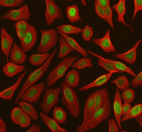 a00039 3 rb1 primary antibodies if testing 1