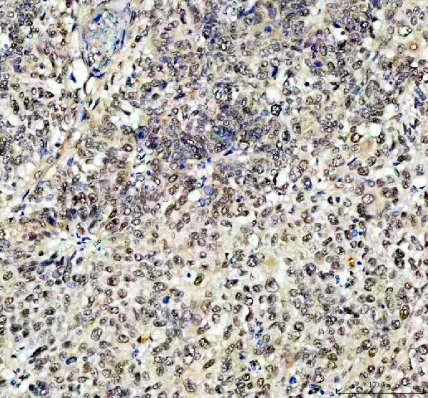a00039 3 rb1 primary antibodies ihc testing 1
