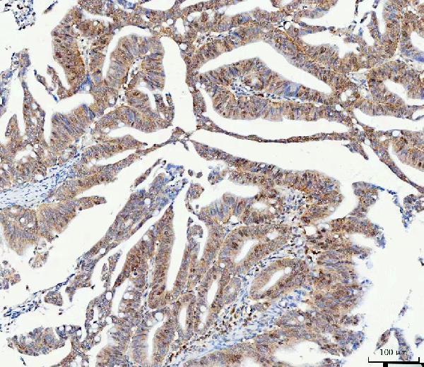  IHC analysis of RB1 using anti-RB1 antibody (A00039-3)