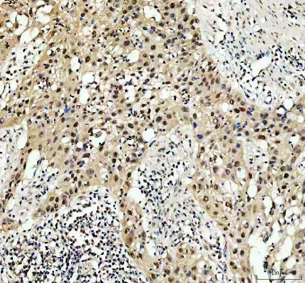 a00039 3 rb1 primary antibodies ihc testing 2_1