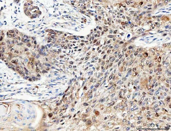  IHC analysis of RB1 using anti-RB1 antibody (A00039-3)