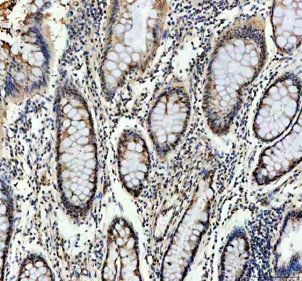 a00039 3 rb1 primary antibodies ihc testing 3_1