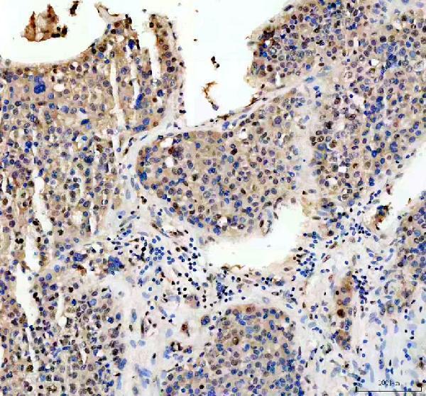 a00039 3 rb1 primary antibodies ihc testing 4