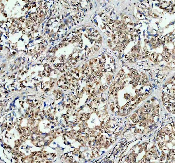 a00039 3 rb1 primary antibodies ihc testing 5