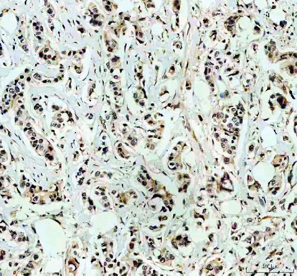 a00039 3 rb1 primary antibodies ihc testing 6