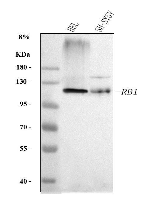  Western blot analysis of RB1 using anti-RB1 antibody (A00039-3)