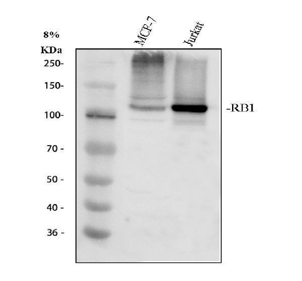 a00039 3 rb1 primary antibodies wb testing 1_1