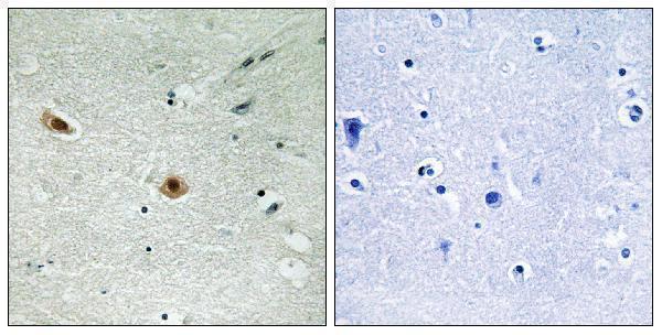 Immunohistochemistry analysis of paraffin-embedded human brain, using Retinoblastoma (Phospho-Ser608) Antibody