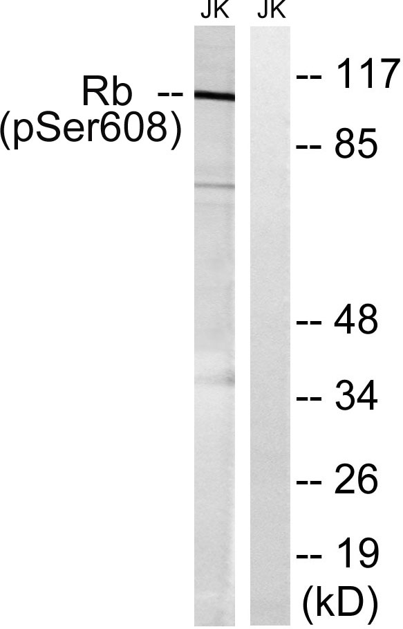 Western blot analysis of lysates from Jurkat cells treated with PMA 125ng/ml 30', using Retinoblastoma (Phospho-Ser608) Antibody