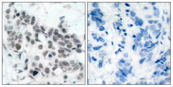 a00039s780 1 rb1 primary antibodies ihc testing 5