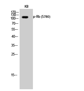 Western Blot analysis of KB cells using Phospho-Rb (S780) Polyclonal Antibody cells nucleus extracted by Minute TM Cytoplasmic and Nuclear Fractionation kit 