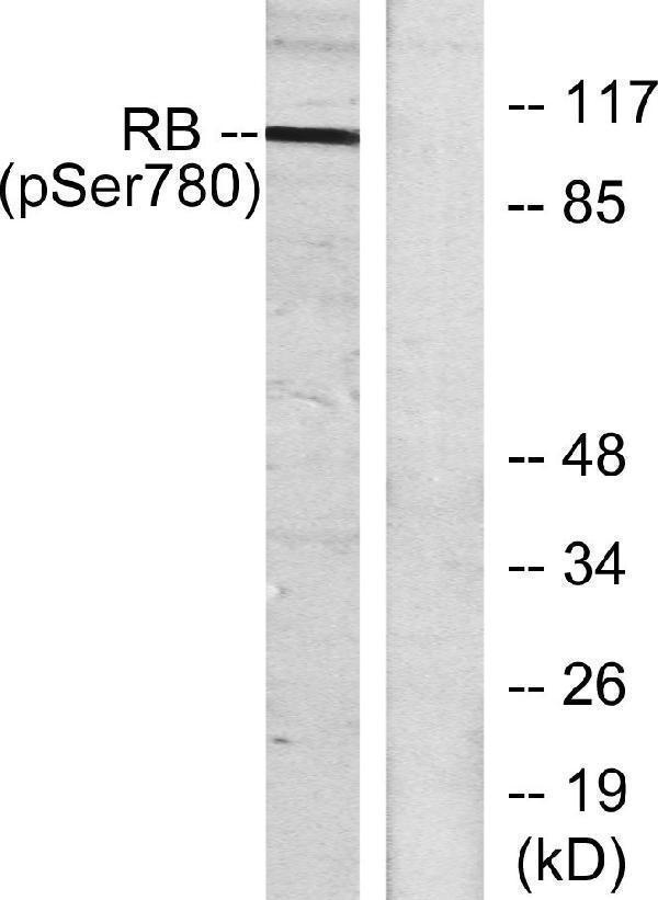 Western blot analysis of lysates from K562 cells treated with serum 10%, using Retinoblastoma (Phospho-Ser780) Antibody