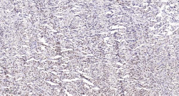 a00039s788 rb1 primary antibodies ihc testing 1