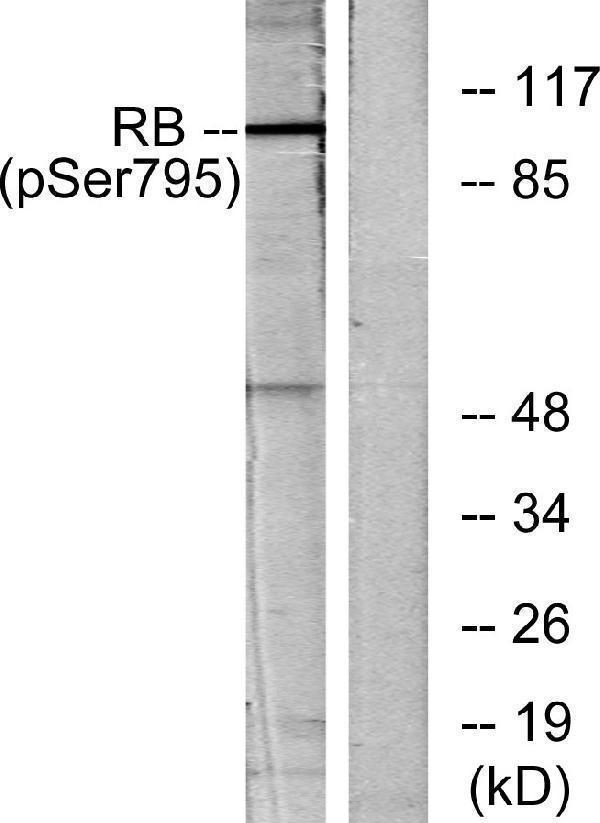 Western blot analysis of lysates from K562 cells treated with serum 10%, using Retinoblastoma (Phospho-Ser795) Antibody