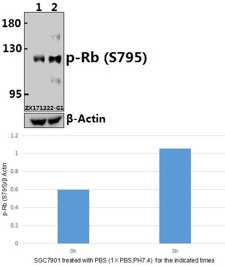 Western blot (WB) analysis of p-Rb (S795) pAb at 1:500 dilution
Lane1:SGC7901 whole cell lysate(40ug)
Lane2:SGC7901 treated with PBS (1×PBS,PH7