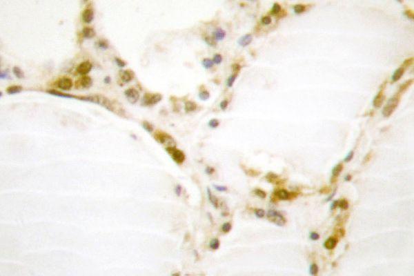 Immunohistochemistry (IHC) analyzes of Rb (S807) pAb in paraffin-embedded human thyroid gland tissue
