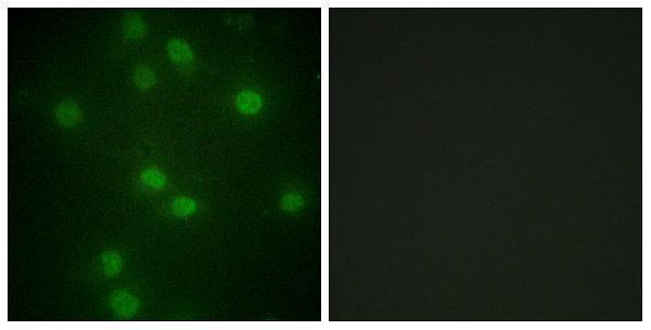 Immunofluorescence analysis of HUVEC cells, using Retinoblastoma (Phospho-Ser811) Antibody