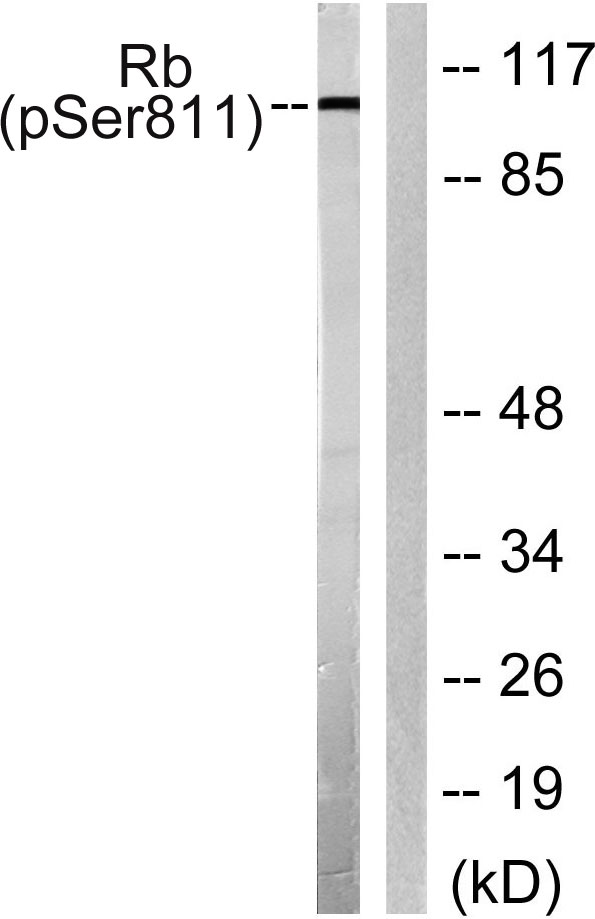 Western blot analysis of lysates from K562 cells, using Retinoblastoma (Phospho-Ser811) Antibody