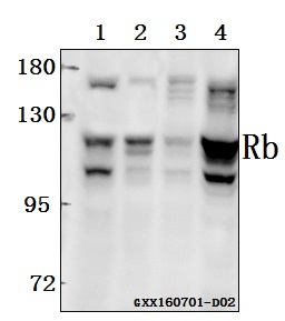 Western blot (WB) analysis of Rb (T601) polyclonal antibody pAb at 1:500 dilution
Lane1:SGC7901 whole cell lysate(40ug)
Lane2:HEK293T whole cell lysate(20ug)
Lane3:SK-OVCAR3 whole cell lysate(40ug)
Lane4:786-O whole cell lysate(40ug)