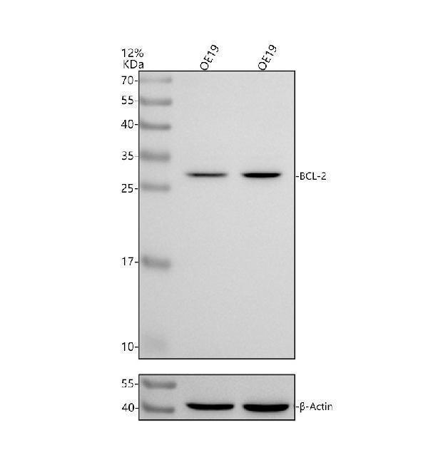 a00040 2 bcl2 primary antibodies wb testing 2
