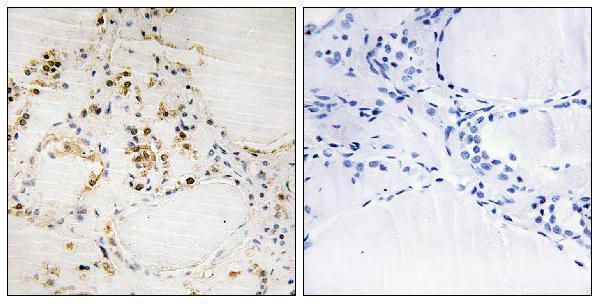 a00040s87 bcl2 primary antibodies ihc testing 1