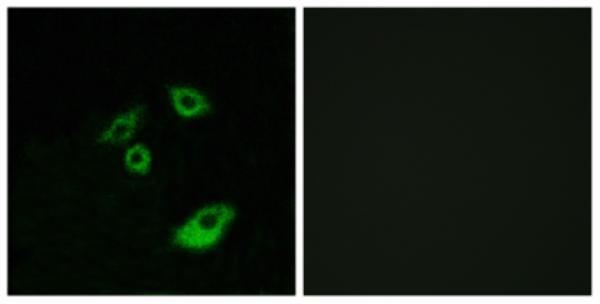 a00040t56 1 bcl2 primary antibodies if testing 5