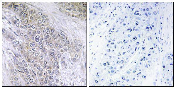 a00040t56 1 bcl2 primary antibodies ihc testing 4