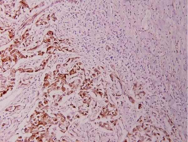 a00040t56 bcl2 primary antiboties ihc testing 2