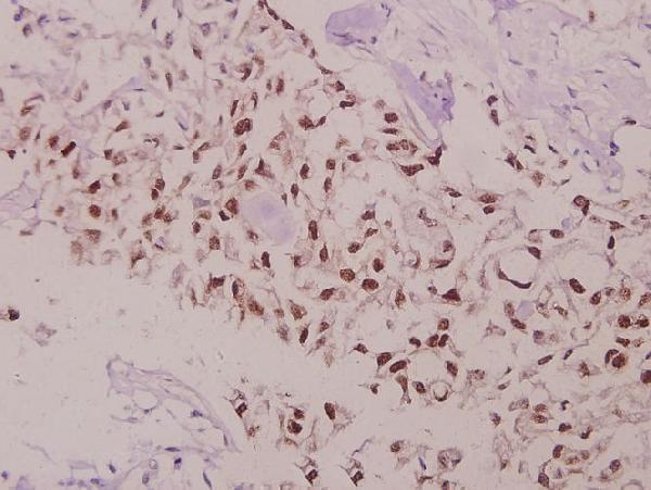 a00040t69 bcl2 primary antiboties ihc testing 2