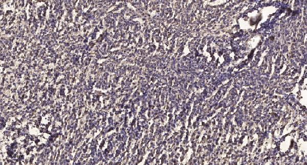 a00040t74 bcl2 primary antibodies ihc testing 1