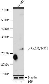 Western blot analysis of extracts of A-431 cells, using Phospho-Rac1/2/3-S71 antibody  at 1:1000 dilution