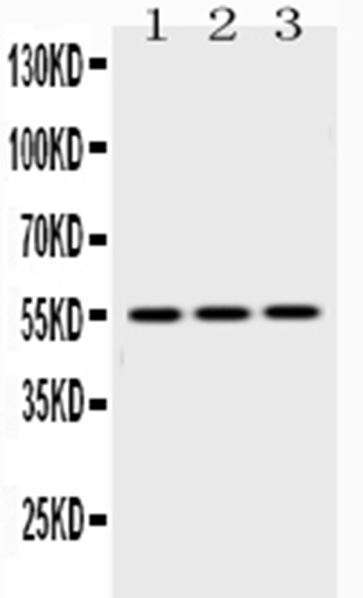  Western blot analysis of Caspase8 using anti-Caspase8 antibody (A00042)