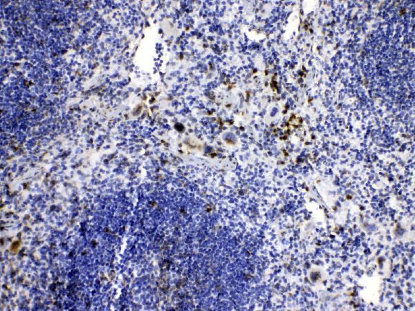  IHC analysis of Caspase8 using anti-Caspase8 antibody (A00042)