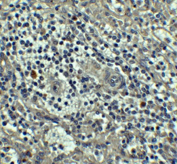 Immunohistochemistry of Caspase-8 in human spleen tissue with Caspase-8 antibody at 5 μg/mL
